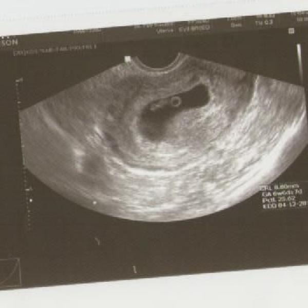 Můj těhotenský deníček ! na Moje těhotenství.cz Můj těhotenský deníček !