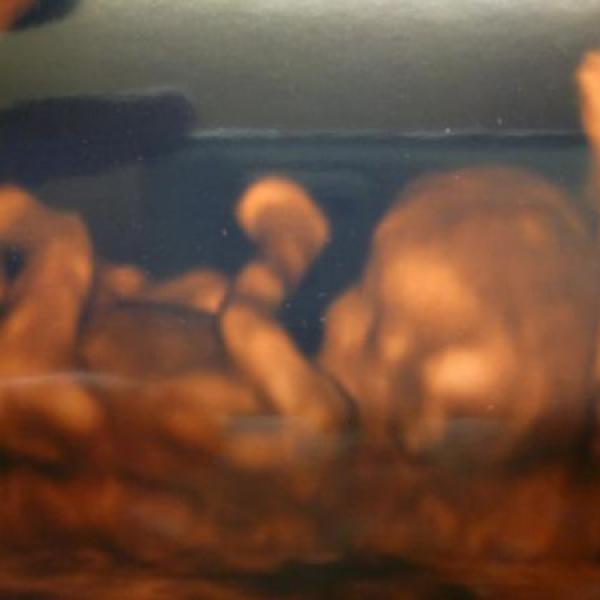 Tak to jsme my... na Moje těhotenství.cz Tak to jsme my...