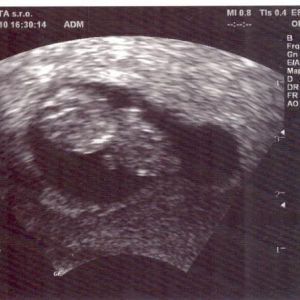 Fotečka našeho drobečka - týden 9+0 ;) na Moje těhotenství.cz Fotečka našeho drobečka - týden 9+0 ;)