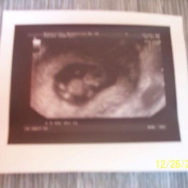 Už máme 1.fotečku miminka