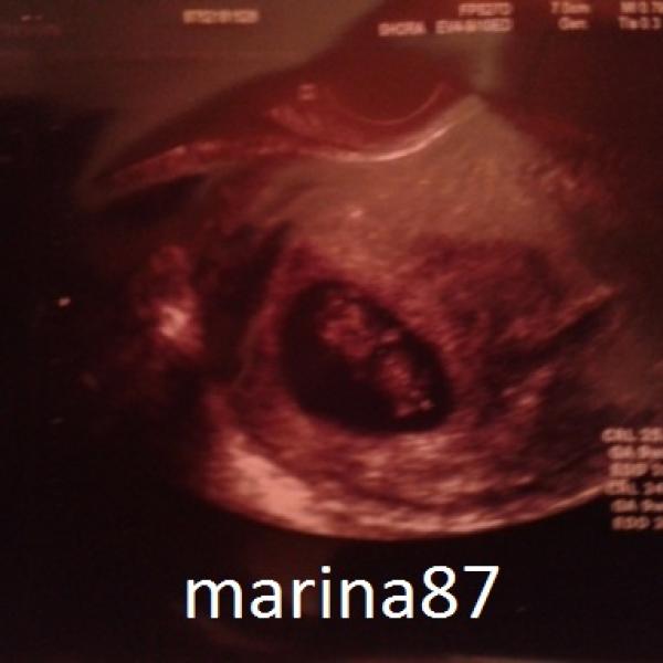 První ultrazvuky červňátek 2013 :)