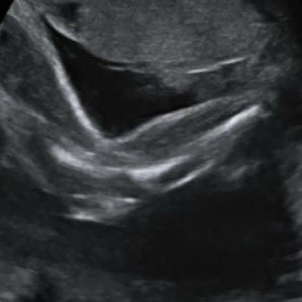 Nemůžu v noci spát