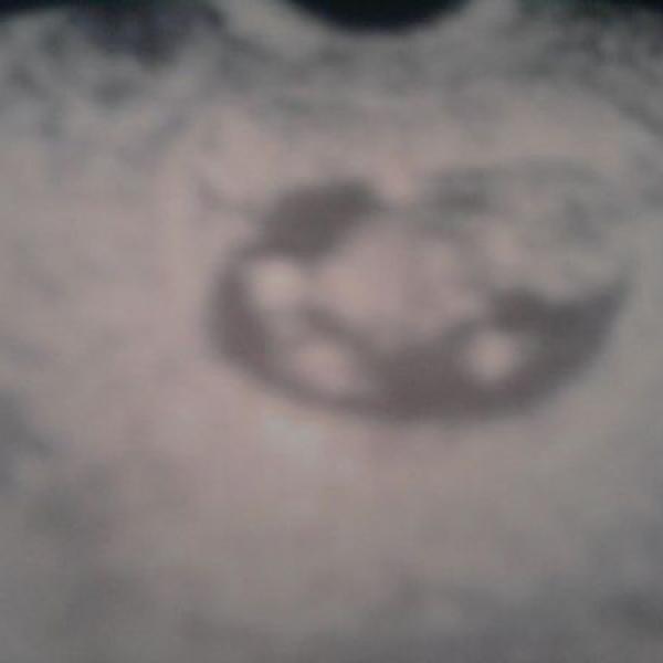 moje první těhotenství