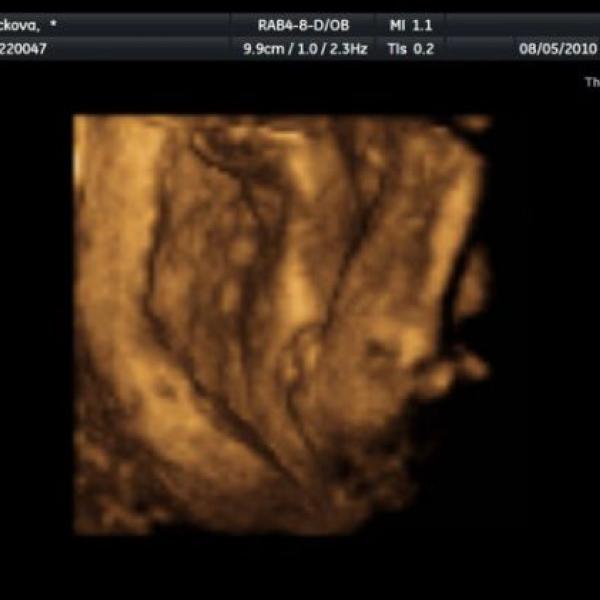 co myslíte že to bude? :-)