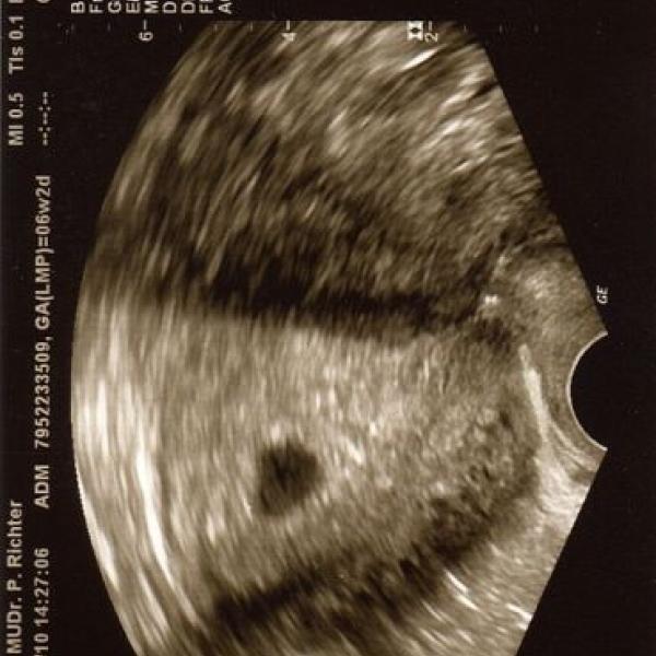 NAŠE PRVNÍ FOTEČKA