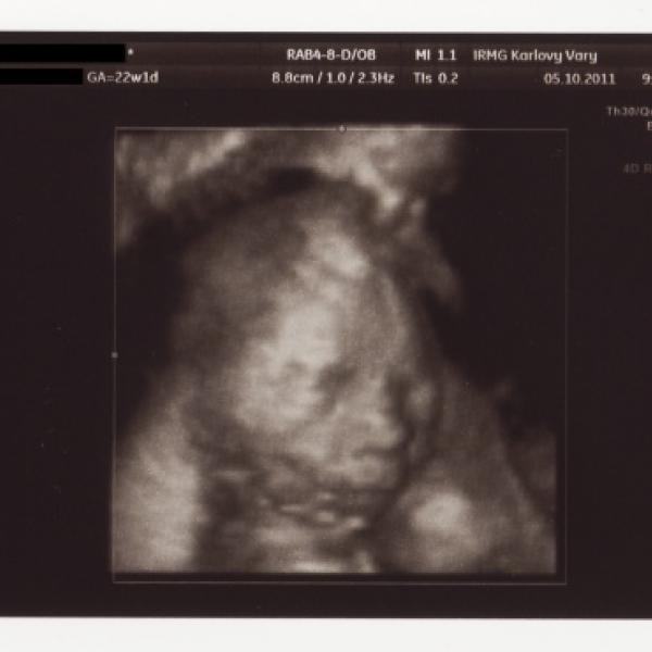 Velký ultrazvuk, 22. týden