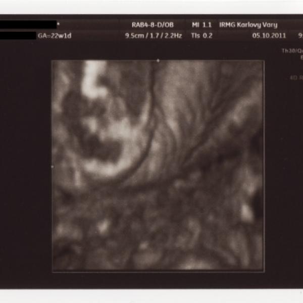 Velký ultrazvuk, 22. týden