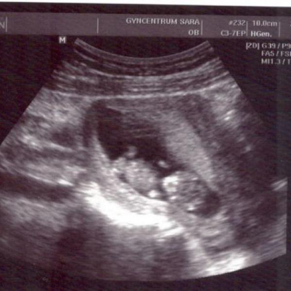 Další fotečka a konečně průkazka na Moje těhotenství.cz Další fotečka a konečně průkazka