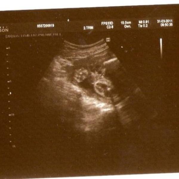 Co je v bříšku ???