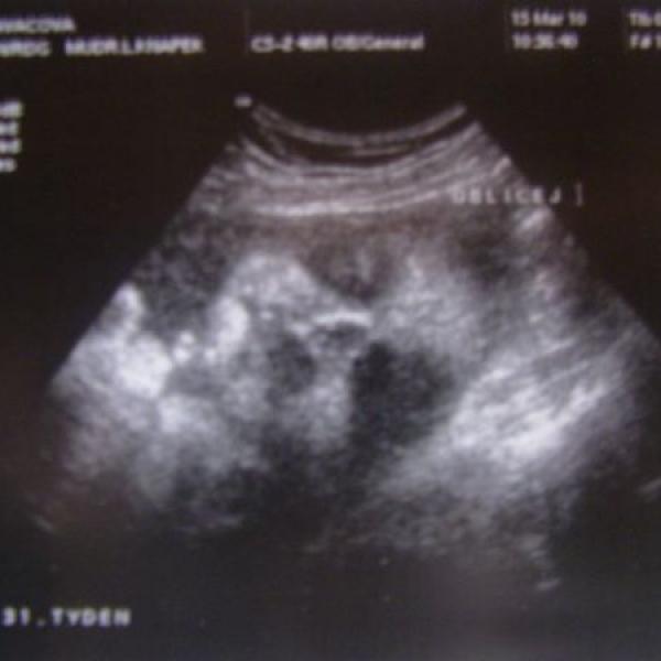 UZ 32 tt a fotečky z 34 tt