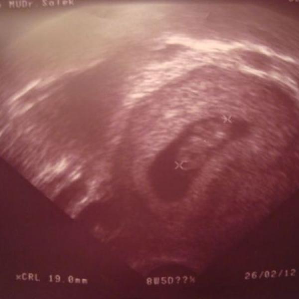 První kontrola u dr.