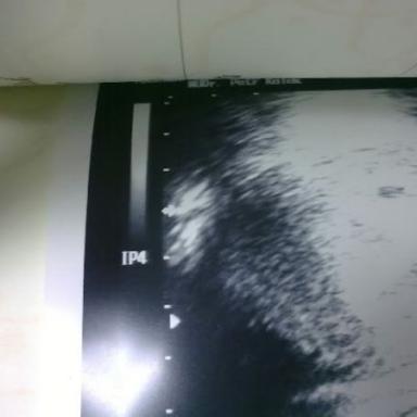 Moje mini tecka :-)