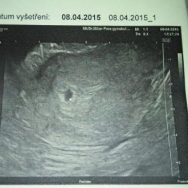 POTVRZENO Adrianka bude mit sourozence :-) 