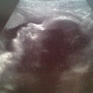 Náš poslední velký UTZ ve 31+3 :-)