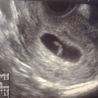 VČEREJŠÍ POHOTOVOST !!!