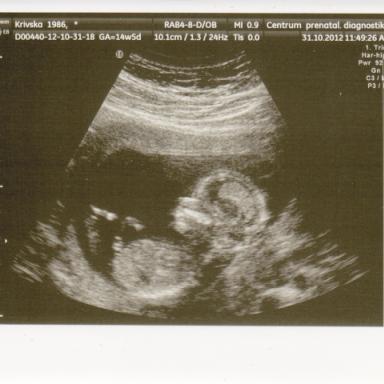 Kontrola na Veveří Brno a poradna