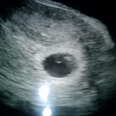 Už máme srdíčko!