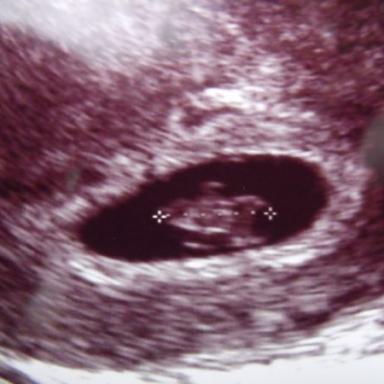 Ahoj holky, můžu mezi vás?