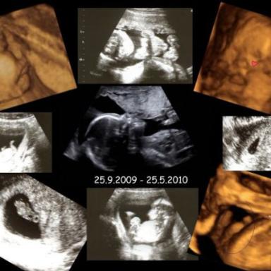 25.9.2009 - 25.6.2010 = OD 6tt TĚHOTENSTVÍ AŽ PO PRVNÍ MĚSÍC ŽIVOTA :)!