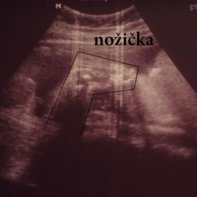 Dnešní poradna 31+3tt ,velký UZ,údaje v průkazce