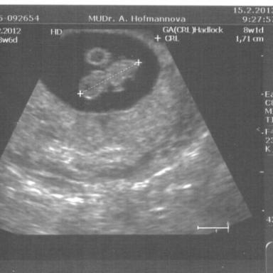 1. PORADNA 8+6 &lt;3