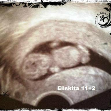 Gallerie utz kolem 10tt - KVĚTŇÁTKA 2013 ♥