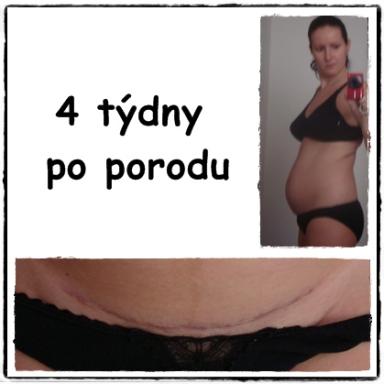 ... 4 týdny po porodu ... a já jsem pořád jak těhule :D