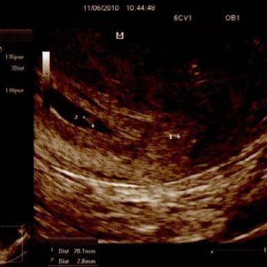 Jsem štastná jako blecha:-)