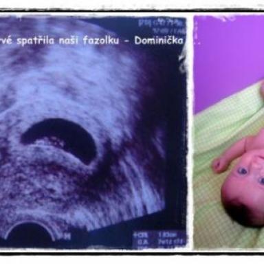 ... DNES JE TO PŘESNĚ ROK, CO JSEM POPRVÉ SPATŘILA NAŠI FAZOLKU - DOMINIČKA :)