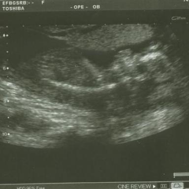 Tak je to asi holčička :o)